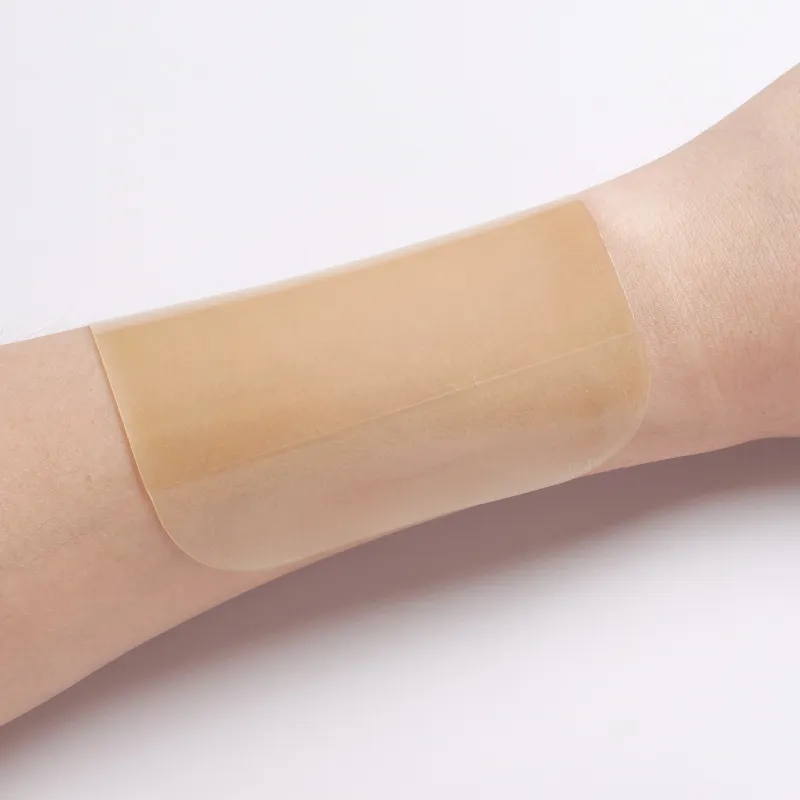 Гидроколлоидная повязка (4)